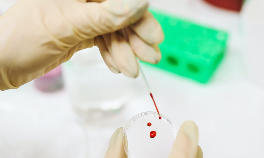 Tipo sanguíneo: A, B, AB e O, qual é o seu?