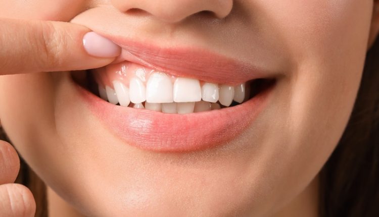 Como a saúde mental pode afetar diretamente a saúde do sorriso?