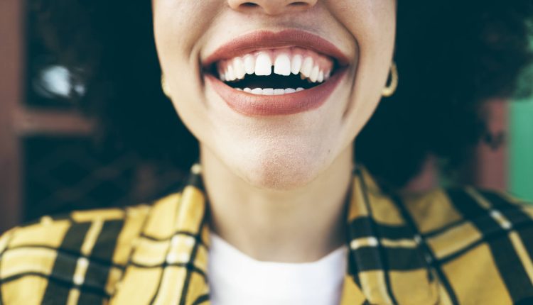 Dentes