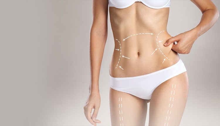 Carboxiterapia para emagrecimento e modelagem corporal, veja tudo aqui