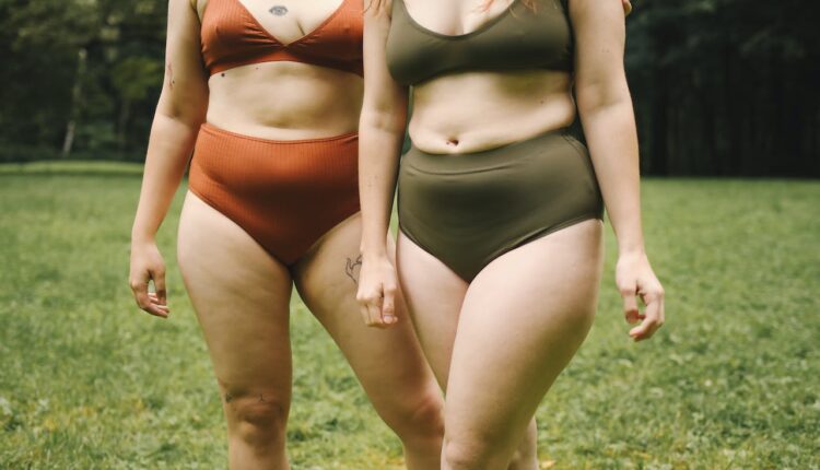 celulite tem cura? veja formas de resolver o problema